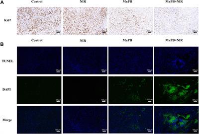 Manganese-Based Prussian Blue Nanocatalysts Suppress Non-Small Cell Lung Cancer Growth and Metastasis via Photothermal and Chemodynamic Therapy